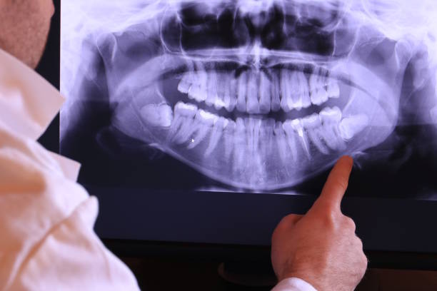 Best Emergency Root Canal Treatment in Wmette, IL